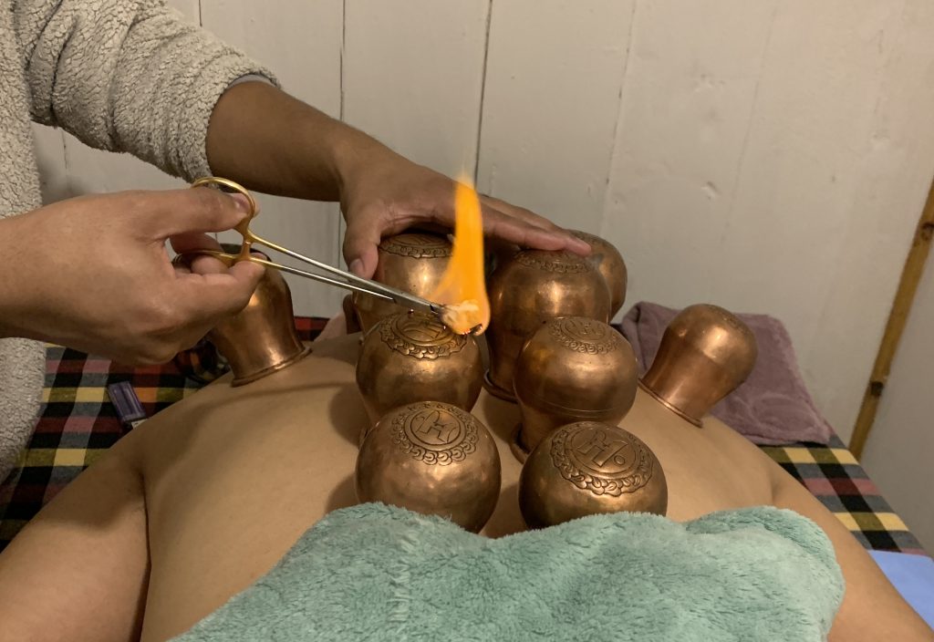 Copper Cupping